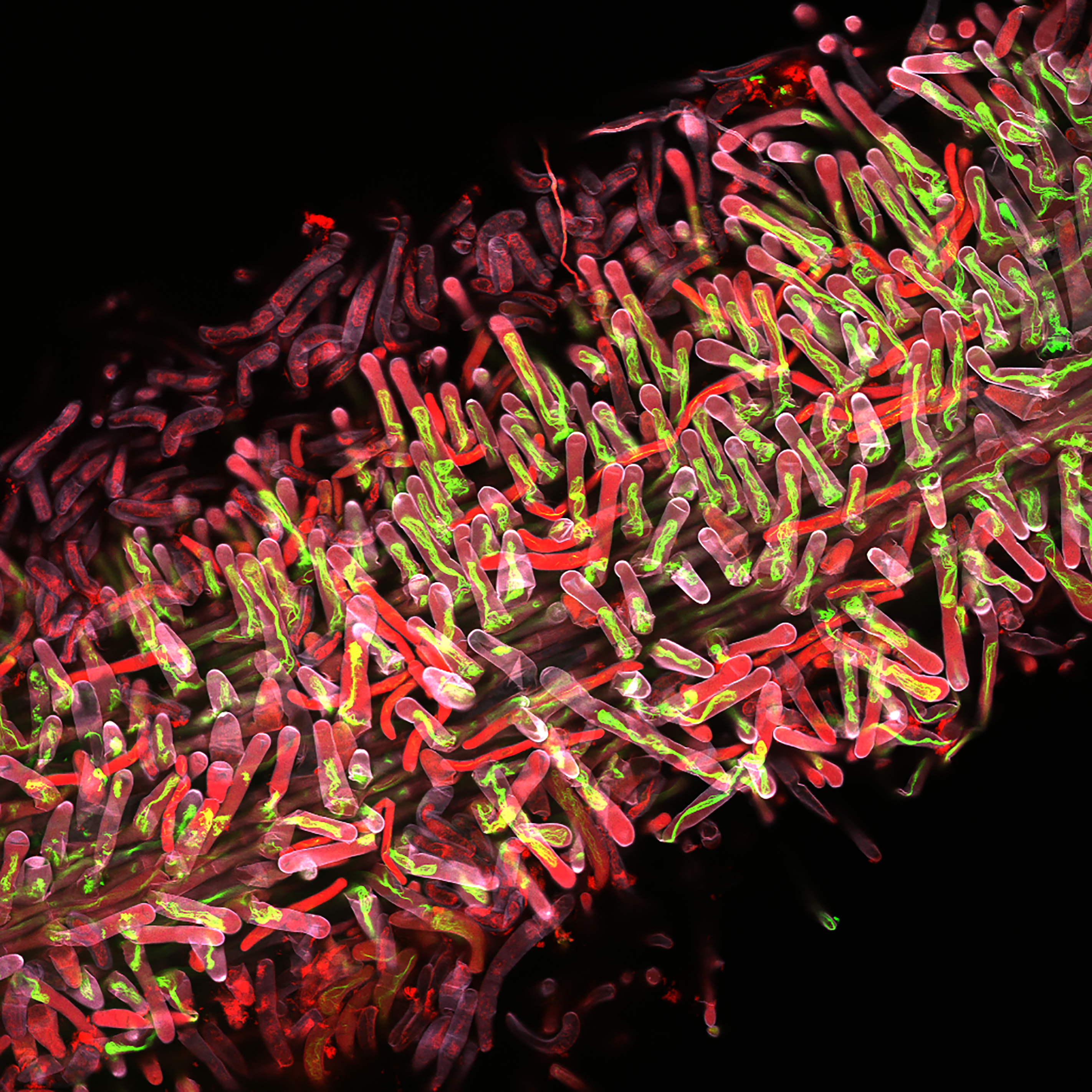 Part of a Medicago truncatula root showing the root hairs (red) which take up nutrients from the soil. Green labelled are the actin filaments, part of the cells skeleton and transport highways that help these hairs to grow and to fulfil their function. (I