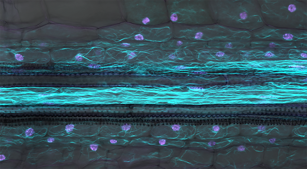 In a cross-section of the root of the legume Medicago truncatula a part of a cells internal skeleton, actin filaments (cyan) become visible. They surround all major internal compartment of the cell including the nuclei (magenta). The central cells are par