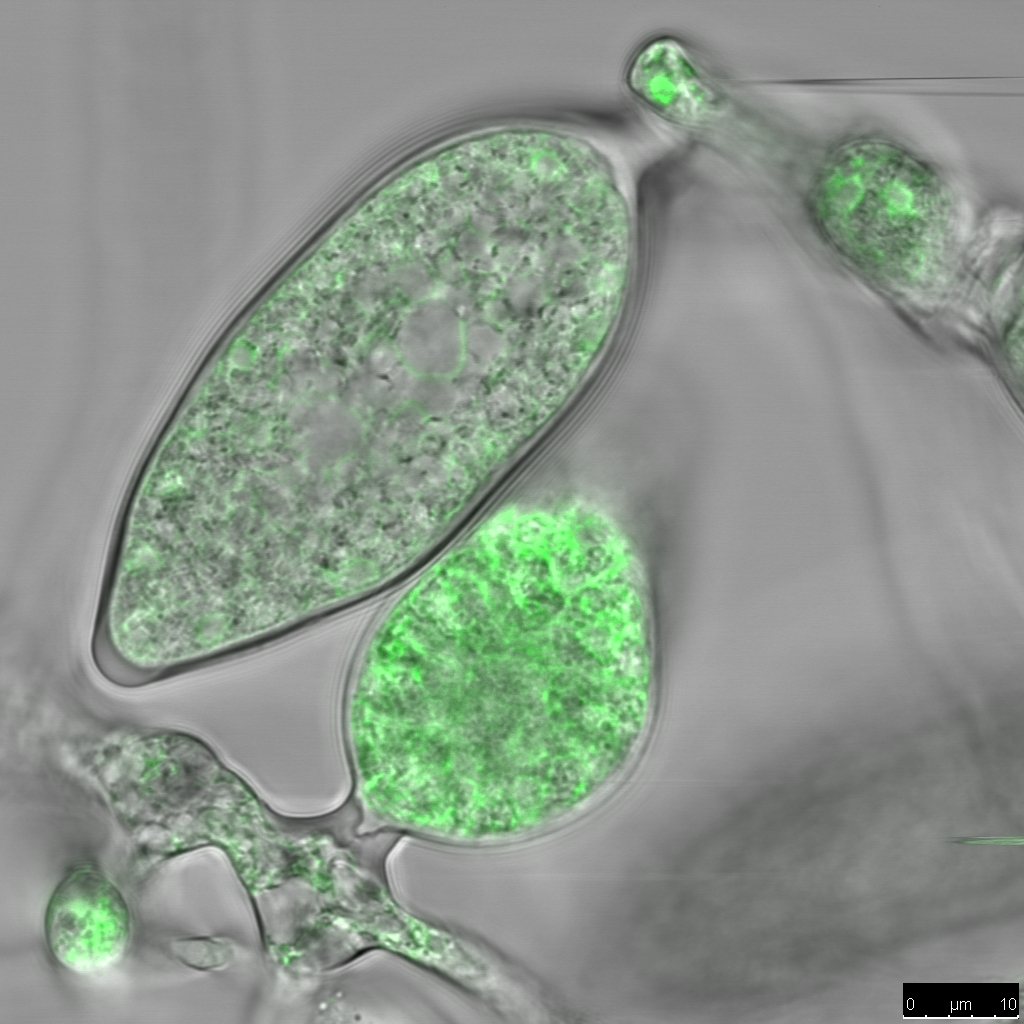 Hyphae with reproductive structures, termed sporangia, of Phytophthora palmivora. These can open up and release numerous swimming zoospores that can then reinfect additional tissues. In plants without API the pathogen can form much less of these and there