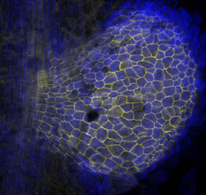 A developing nodule on a Medicago truncatula root with cell wall staining. Image by Colleen Drapek.