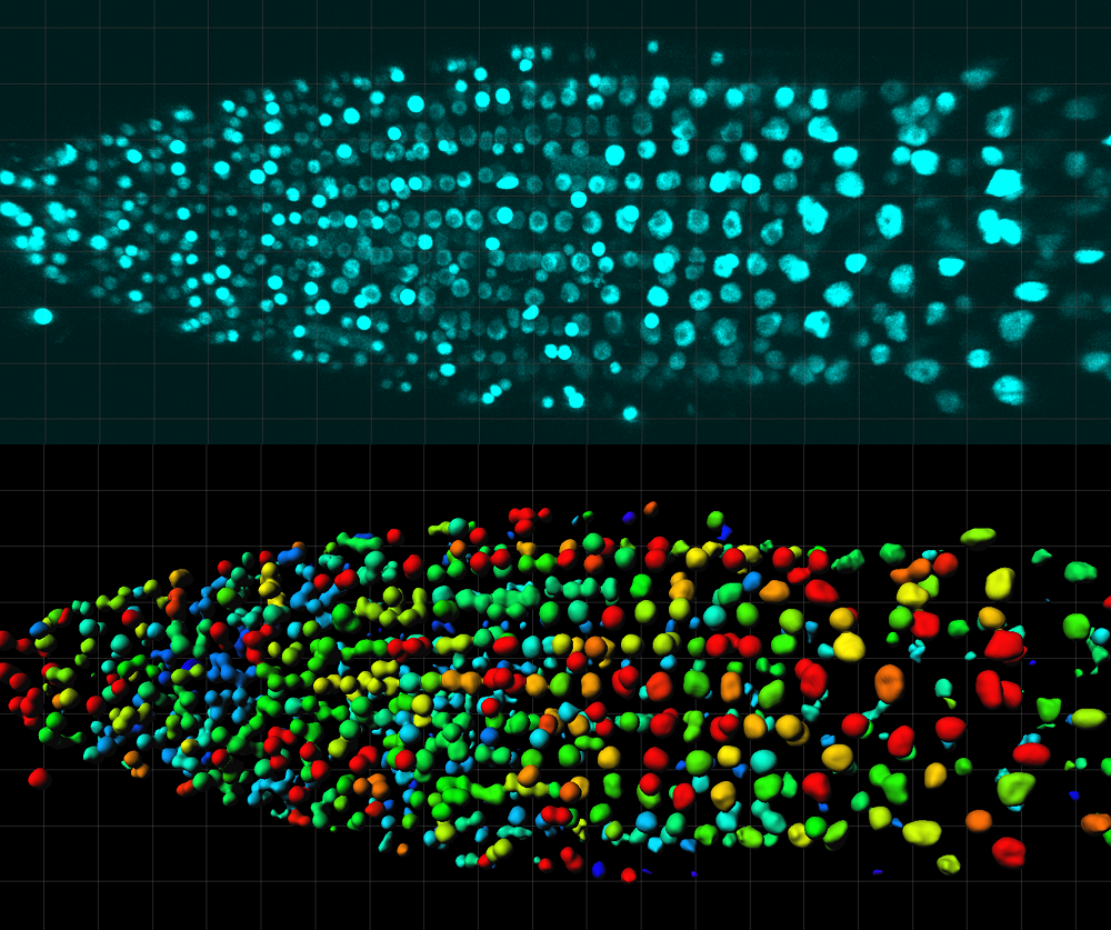 Confocal image of HSP70 gene expression at single cell level in Arabidopsis root. Image by Rituparna Goswami.