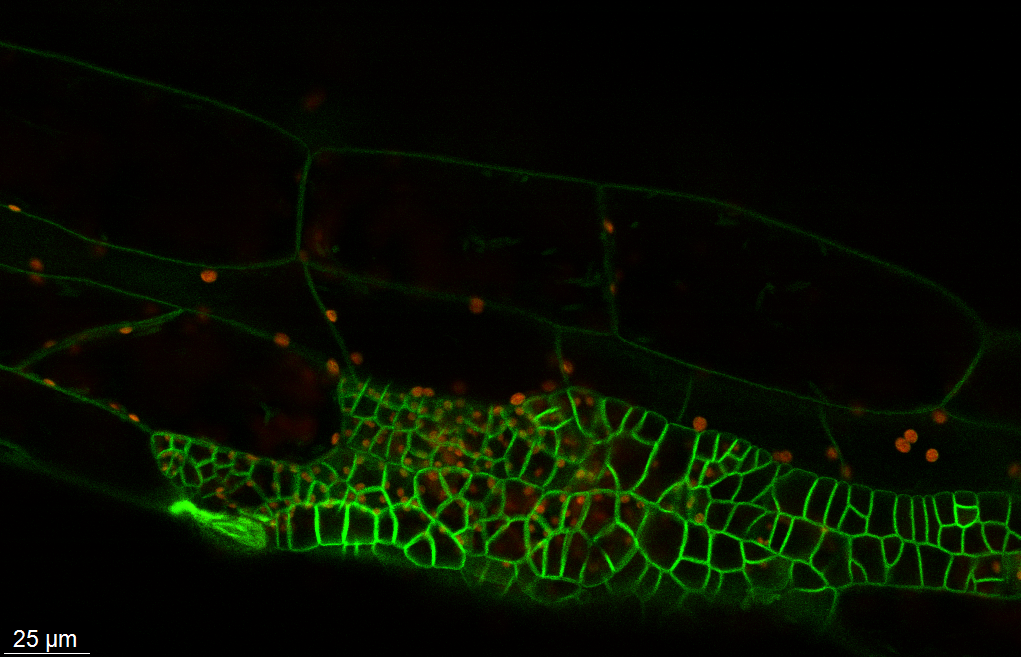 Confocal microscopy images of an Arabidopsis thaliana hypocotyl where localised sectors of over expressing CYCD3-1 gene-Image by Mahwish Ejaz
