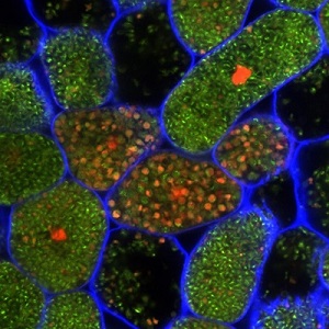 Confocal microscopy images showing the morphology of the intracellular bacteria in nodule cells. In this picture, live bacteria show mainly a rod shape (in green) but died once converted into spheric shape bacteroids, the nitrogen fixing form of bacteria 