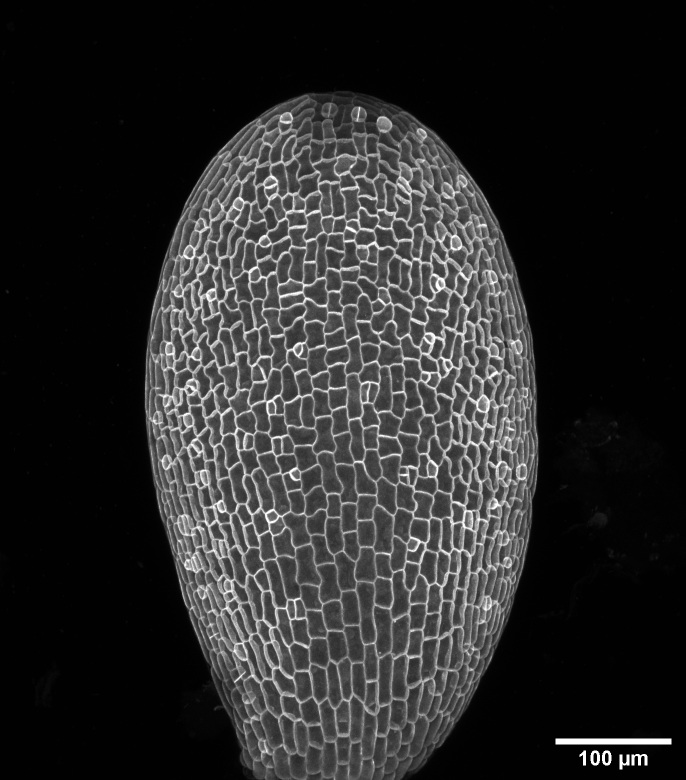 Time lapse recording showing the onset of division in epidermis during early cotyledon development in Arabidopsis thaliana. Image by Leo Serra.