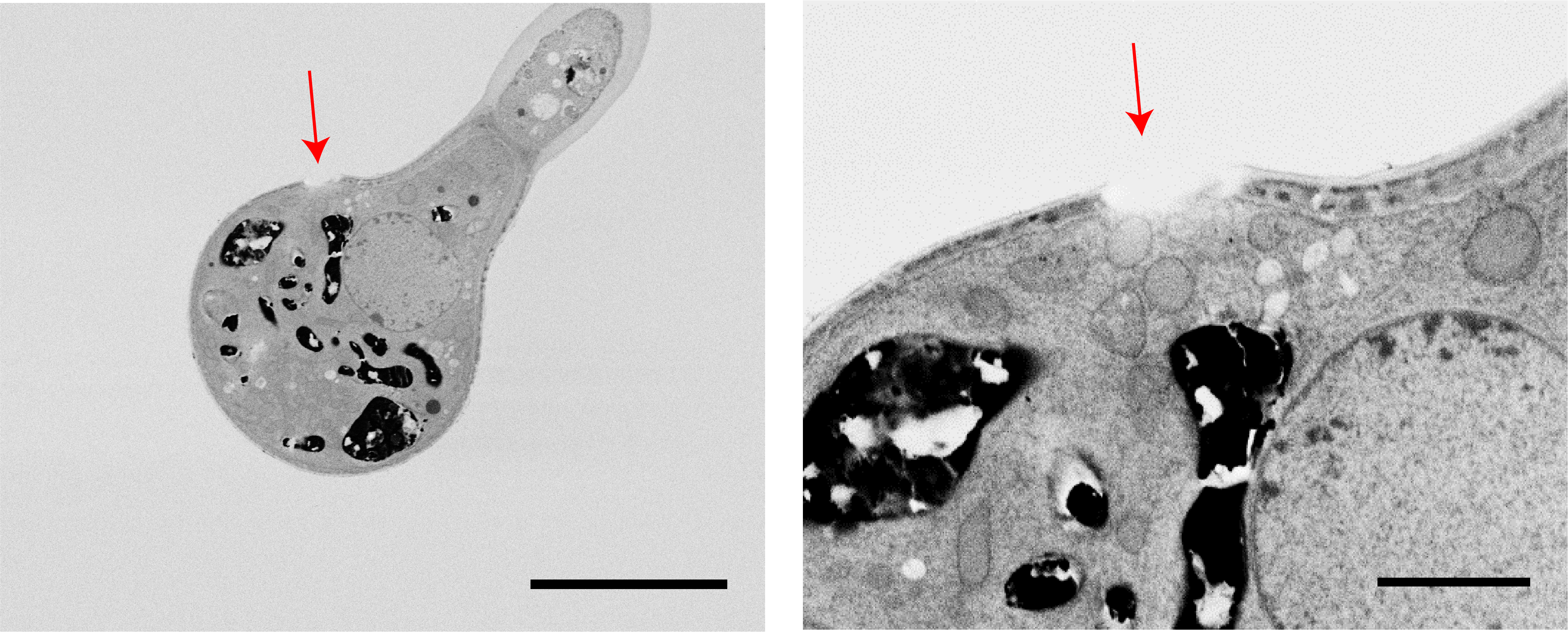 Electron microscope images of stained sections of trichomes of Dionysia tapetodes. Images by Matthieu Bourdon and Karin Müller.