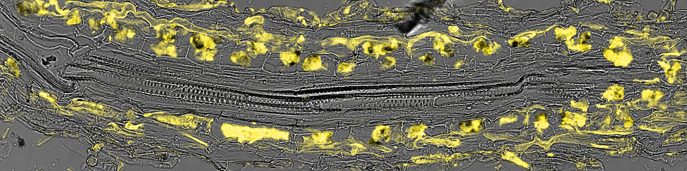 Detection of gene activity of a FOLD gene (black spots) specifically in the structures formed by the symbiotic fungus Rhizophagus irregularis (labelled in yellow) within legume root cells. Image by Edouard Evangelisti.