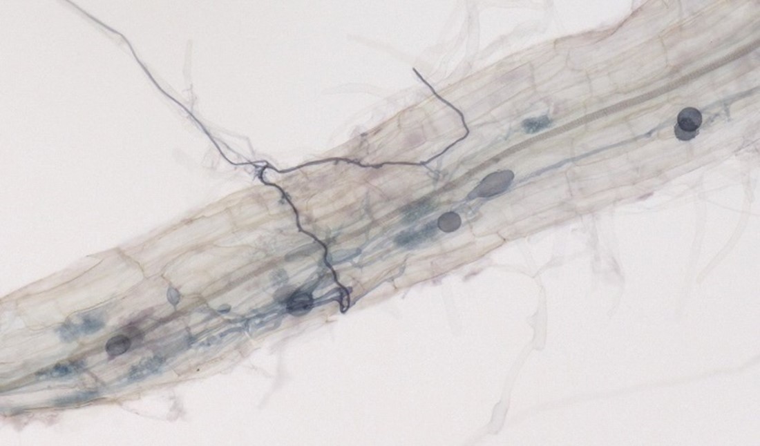 Nicotiana benthamiana root infected by the arbuscular mycorrhizal fungus Rhizophagus irregularis. Picture shows a fungal hyphae (in blue) crawling on a root hair and penetrates to plant intercellular space. 