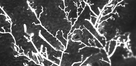 Phytophthora palmivora hyphae growing across thallus of Marchantia polymorpha (liverwort)