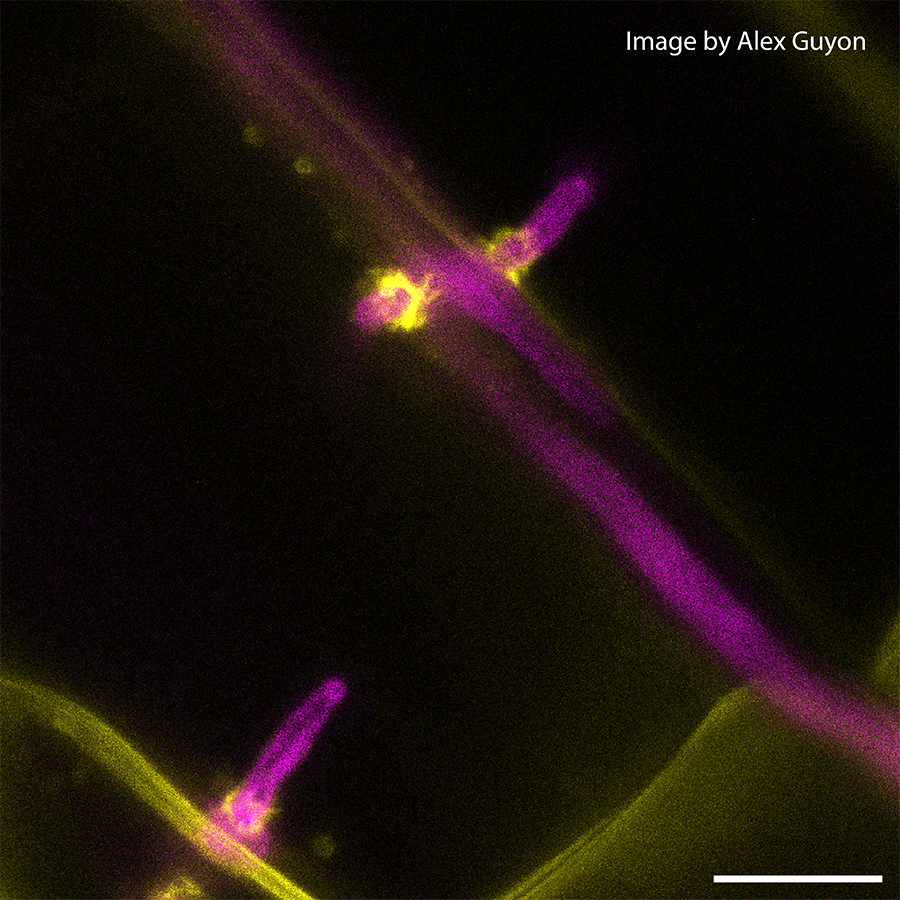 Phytophthora palmivora haustoria infecting the roots of Nicotiana benthamiana, a wild tobacco relative, that the study will employ as a test plant. Image by Alex Guyon.