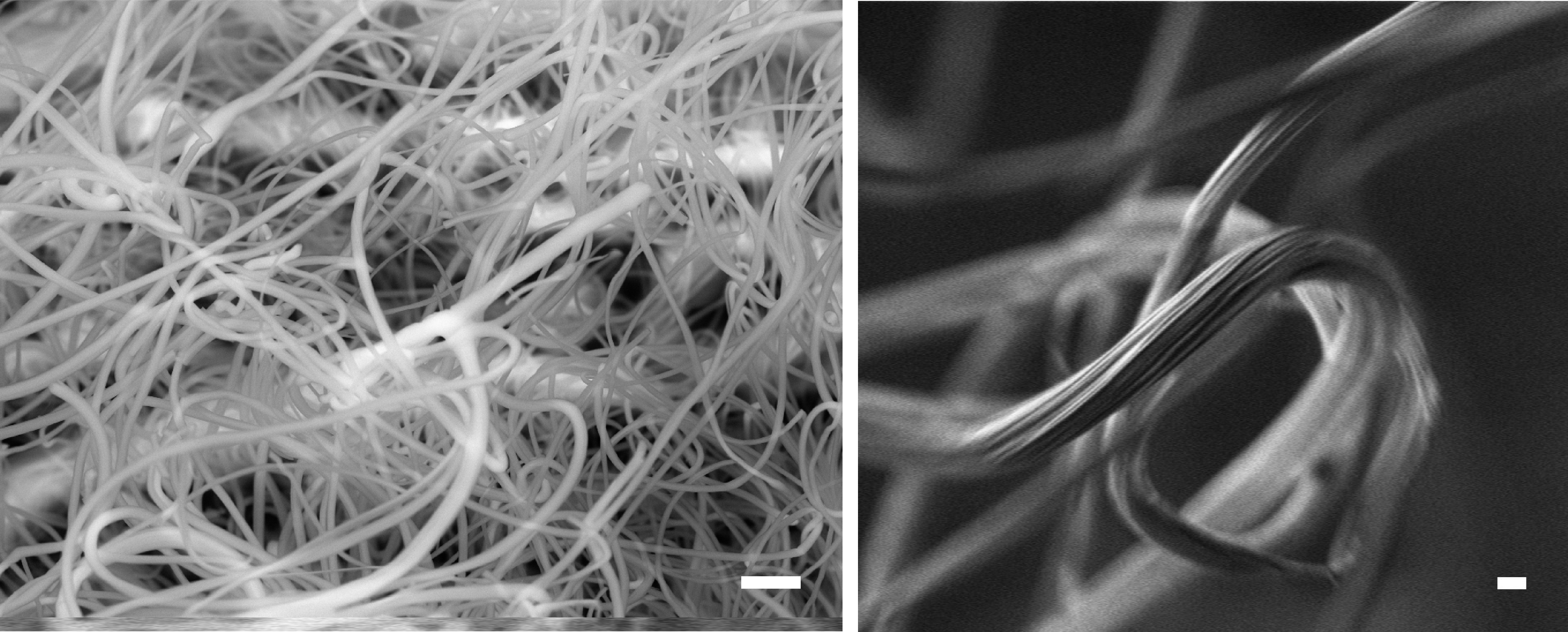 Scanning electron microscope image of woolly fibres on Dionysia tapetodes. Images by Raymond Wightman and Trevor Groves.