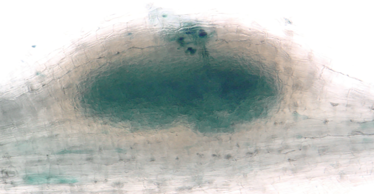 Symbiotic root nodule in the model legumes Medicago truncatula induced in response to successful recognition and infection with the beneficial nitrogen-fixing rhizobium bacteria Sinorhizobium meliloti (stained in blue).