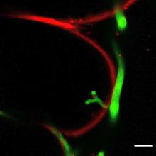 Infection of Marchantia cells by the pathogen Phytophthora palmivora (green). Pathogen hyphae (thick, green) grow between cells and penetrate through the plant cell wall (red) into living Marchantia cells to form branched intracellular hyphae.