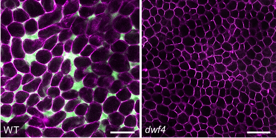 Palisade mesophyll cells of a wild type A. thaliana leaf (left) and the dwf4 mutant with reduced air spaces (right). Images by James Fitzsimons. Palisade mesophyll cells of a wild type A. thaliana leaf (left) and the dwf4 mutant with reduced air spaces (right).