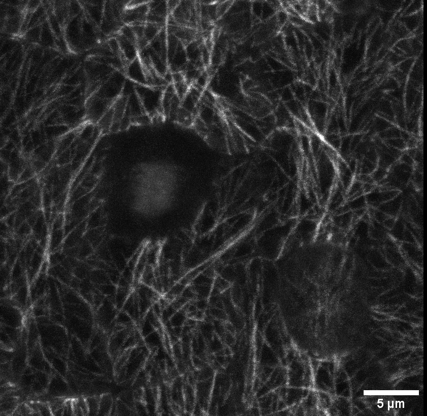 Cell division movie showing microtubules behaviour. Image by Leo Serrra. Cell division movie showing microtubules behaviour. Image by Leo Serrra.