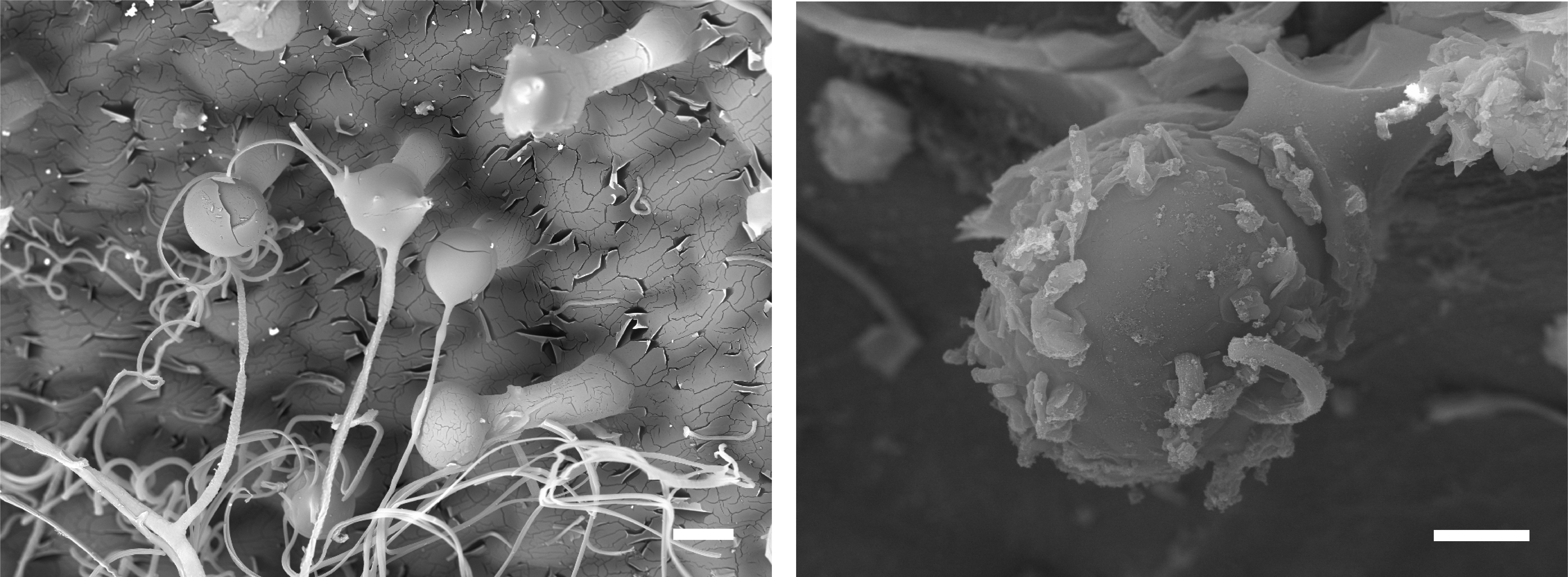Scanning electron microscopy showing woolly fibres on Dionysia tapetodes emerging from glandular trichomes. Images by Raymond Wightman. Scanning electron microscopy showing woolly fibres on Dionysia tapetodes emerging from glandular trichomes. Images by Raymond Wightman.