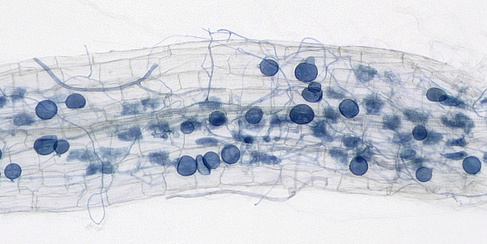 The Automatic Mycorrhiza Finder (AMFinder) allows for automatic computer vision-based identification and quantification of AM fungal colonisation and intraradical hyphal structures on ink-stained root images using convolutional neural networks