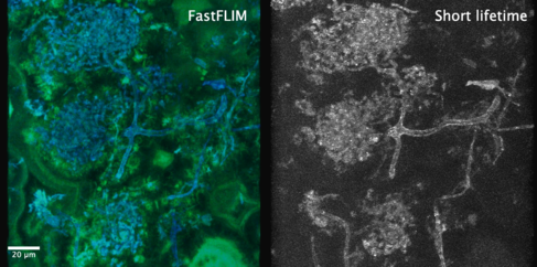 Fluorescence lifetime imaging allows us to better resolve fungal features within the host plant. Image by Raymond Wightman.