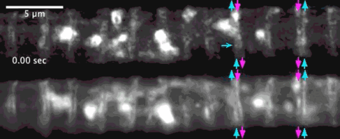 A developing root protoxylem vessel labelled with CSCs (yellow, YFP-CESA7) and actin (red, mCherry:fABD2). 