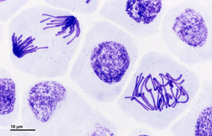 Root meristem of Vicia faba cells in anaphase and prophase stages of mitosis. Image from archive of Josef Reischig and licenced under CC BY SA 3.0 license as a part of Wikimedia Czech Republic's GLAM initiative.
