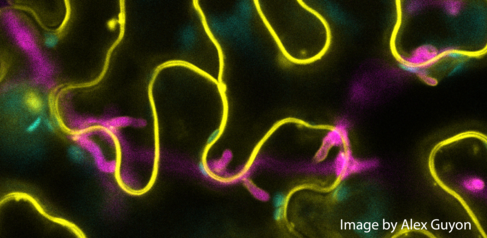 Phytophthora palmivora hyphae under the epidermis with haustoria projecting from below into living Nicotiana benthamiana epidermis cells.  Image by Alex Guyon.