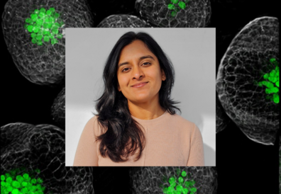 Dr Sonal Yadav with background of microscopy image of shoot meristem of Arabidopsis thaliana