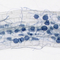 The Automatic Mycorrhiza Finder (AMFinder) allows for automatic computer vision-based identification and quantification of AM fungal colonisation and intraradical hyphal structures on ink-stained root images using convolutional neural networks