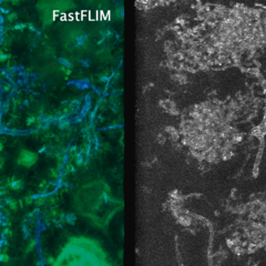 Fluorescence lifetime imaging allows us to better resolve fungal features within the host plant. Image by Raymond Wightman.