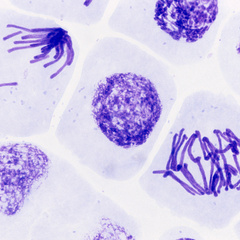 Root meristem of Vicia faba cells in anaphase and prophase stages of mitosis. Image from archive of Josef Reischig and licenced under CC BY SA 3.0 license as a part of Wikimedia Czech Republic's GLAM initiative.