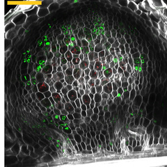 Optical sections of nodule primordia. Image by Ella Greensmith.