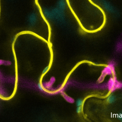 Phytophthora palmivora hyphae under the epidermis with haustoria projecting from below into living Nicotiana benthamiana epidermis cells.  Image by Alex Guyon.