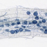 The Automatic Mycorrhiza Finder (AMFinder) allows for automatic computer vision-based identification and quantification of AM fungal colonisation and intraradical hyphal structures on ink-stained root images using convolutional neural networks