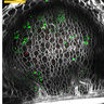Optical sections of nodule primordia. Image by Ella Greensmith.