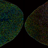 Arabidopsis thaliana leaf under mock (left) versus infection (right) 20 hours after infection: The right leaf shows salcylic acid (SA) accumulation spreading from the site of pathogen invasion.