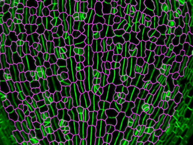 Close-up of stomatal division orientations on leaf under confocal image with Newly formed stomata are highlighted in magenta at 2 days after germination.