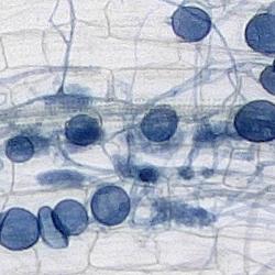 The Automatic Mycorrhiza Finder (AMFinder) allows for automatic computer vision-based identification and quantification of AM fungal colonisation and intraradical hyphal structures on ink-stained root images using convolutional neural networks