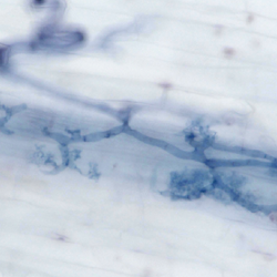 Light microscopy image of a beneficial arbuscular mycorrhiza fungus colonising a barley root (left) and Barley seedlings grown in the laboratory and infected with the root rot fungus Bipolaris sorokiniana resulting in root browning symptoms (right).