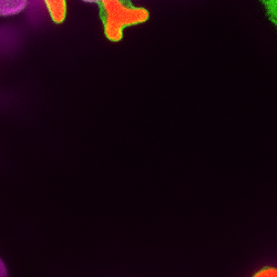 Research shows first land plants were parasitised by microbes