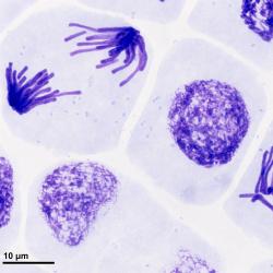 Root meristem of Vicia faba cells in anaphase and prophase stages of mitosis. Image from archive of Josef Reischig and licenced under CC BY SA 3.0 license as a part of Wikimedia Czech Republic's GLAM initiative.