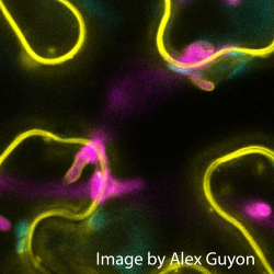 Phytophthora palmivora hyphae under the epidermis with haustoria projecting from below into living Nicotiana benthamiana epidermis cells.  Image by Alex Guyon.