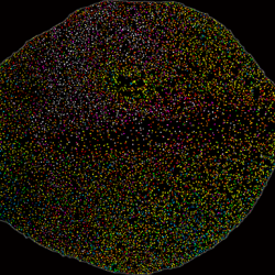 Arabidopsis thaliana leaf under mock (left) versus infection (right) 20 hours after infection: The right leaf shows salcylic acid (SA) accumulation spreading from the site of pathogen invasion.