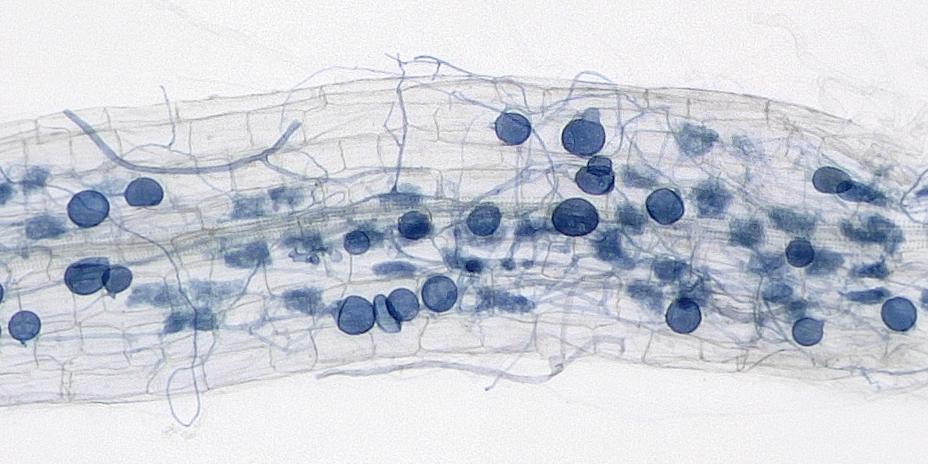 The Automatic Mycorrhiza Finder (AMFinder) allows for automatic computer vision-based identification and quantification of AM fungal colonisation and intraradical hyphal structures on ink-stained root images using convolutional neural networks The Automatic Mycorrhiza Finder (AMFinder) allows for automatic computer vision-based identification and quantification of AM fungal colonisation and intraradical hyphal structures on ink-stained root images using convolutional neural networks