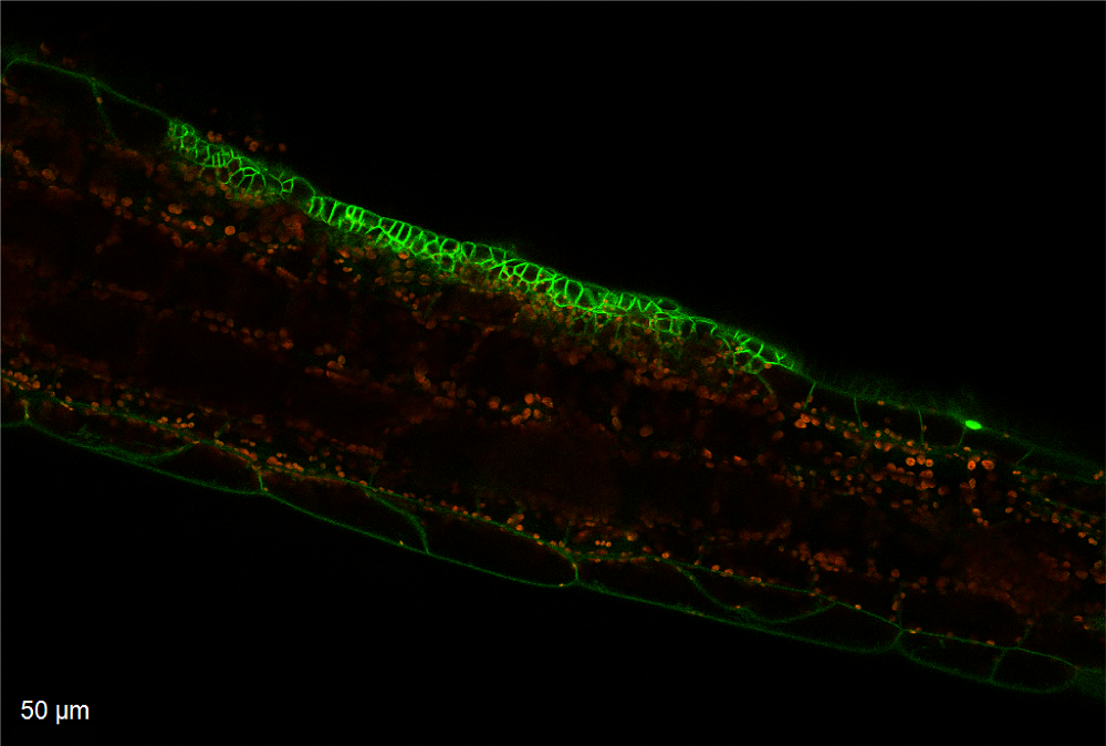 Confocal microscopy images of an Arabidopsis thaliana hypocotyl where localised sectors of over expressing CYCD3:1 gene, a dominant driver of the G1/S transition in the cell cycle induce cell division and changes cell junctions. Image by Mahwish Ejaz. Confocal microscopy images of an Arabidopsis thaliana hypocotyl where localised sectors of over expressing CYCD3:1 gene, a dominant driver of the G1/S transition in the cell cycle induce cell division and changes cell junctions. Image by Mahwish Ejaz.