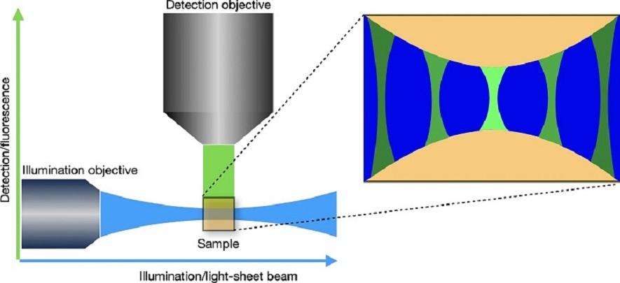 Image Reconstruction in Light-Sheet Microscopy - Spatially Varying Deconvolution and Mixed Noise