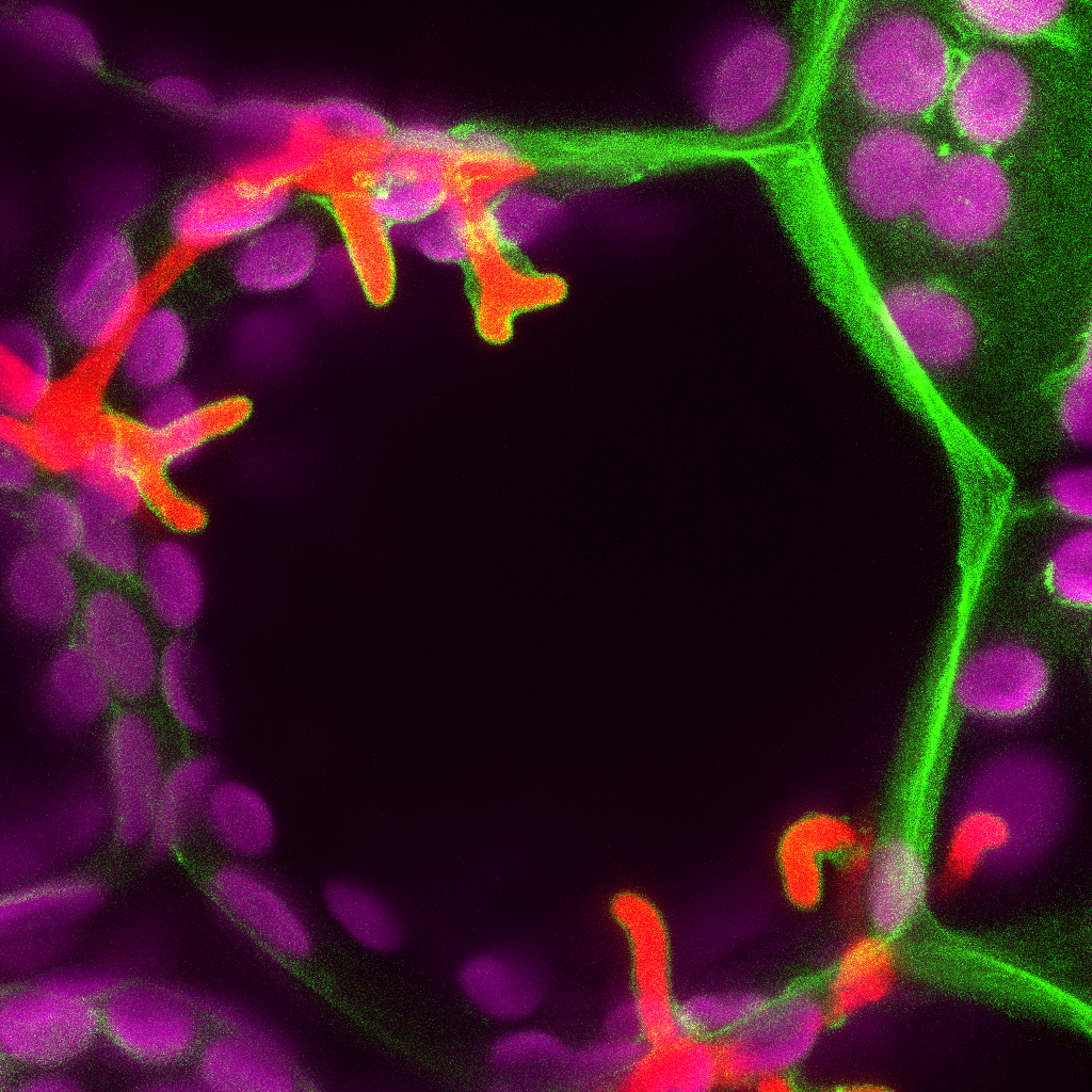 Research shows first land plants were parasitised by microbes