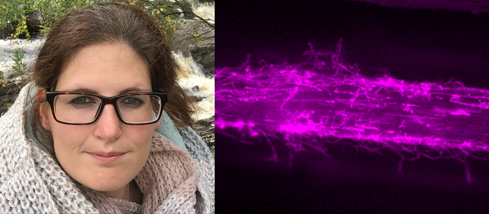 Dr Sabine Brumm and microscopy image of Phytophtora palmivora infecting barley Dr Sabine Brumm and microscopy image of Phytophtora palmivora infecting barley