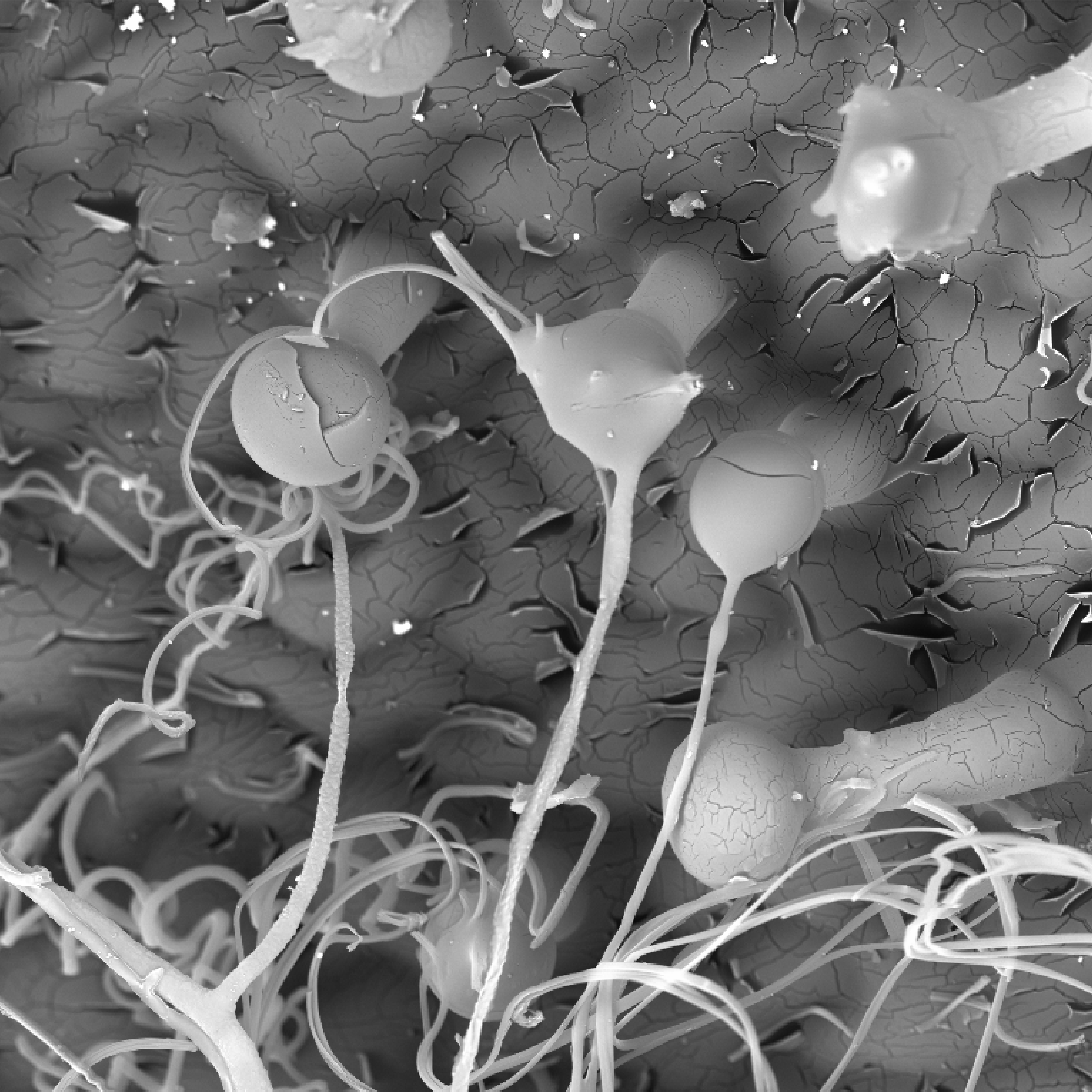 Scanning electron microscope images of woolly fibres on Dionysia tapetodes. Images by Raymond Wightman and Trevor Groves.