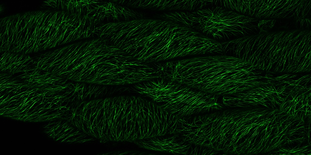 Firas - microtubules in Arabidopsis.jpg