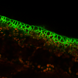 Confocal microscopy images of an Arabidopsis thaliana hypocotyl where localised sectors of over expressing CYCD3:1 gene, a dominant driver of the G1/S transition in the cell cycle induce cell division and changes cell junctions. Image by Mahwish Ejaz.